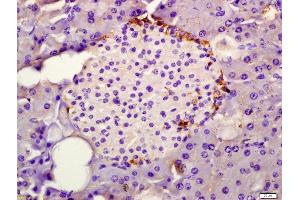 Immunohistochemistry (IHC) image for anti-serine Peptidase Inhibitor, Kazal Type 1 (SPINK1) (AA 66-79) antibody (ABIN681658)