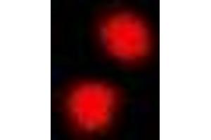 Immunofluorescent analysis of PRDM5 staining in A549 cells. (PRDM5 抗体)