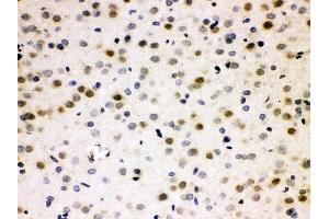 Anti- Cdc25B Picoband antibody, IHC(P) IHC(P): Rat Brain Tissue (CDC25B 抗体  (AA 119-248))