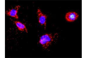 Proximity Ligation Analysis of protein-protein interactions between TP53 and CSNK1D.