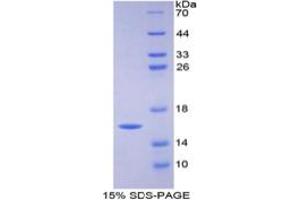 SDS-PAGE of Protein Standard from the Kit (Highly purified E. (FABP3 ELISA 试剂盒)