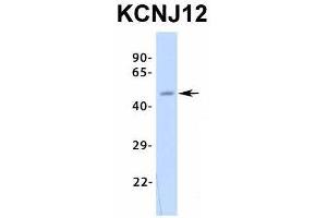 Western Blotting (WB) image for anti-Potassium Inwardly-Rectifying Channel, Subfamily J, Member 12 (KCNJ12) (Middle Region) antibody (ABIN2776235)