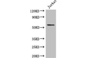 Western Blot Positive WB detected in: Jurkat whole cell lysate All lanes: SPPL2A antibody at 2 μg/mL Secondary Goat polyclonal to rabbit IgG at 1/50000 dilution Predicted band size: 59 kDa Observed band size: 59 kDa (SPPL2A 抗体  (AA 26-172))