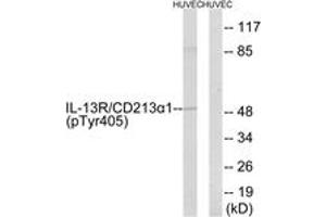 Western blot analysis of extracts from HuvEc cells treated with serum 20% 15', using IL-13R alpha1 (Phospho-Tyr405) Antibody. (IL13 Receptor alpha 1 抗体  (pTyr405))