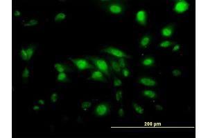 Immunofluorescence of monoclonal antibody to CAPG on HeLa cell. (CAPG 抗体  (AA 1-348))
