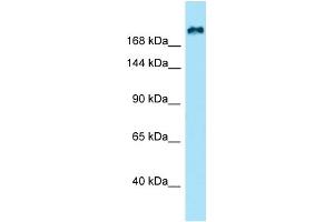 WB Suggested Anti-KIF21B Antibody Titration: 1.