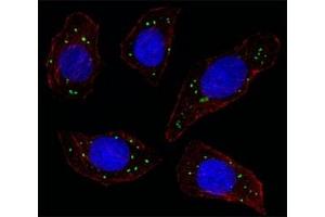 Fluorescent image of U251 cell stained with MERTK antibody at 1:25. (MERTK 抗体)
