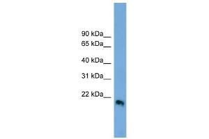 IFN Beta 1 antibody used at 1 ug/ml to detect target protein. (IFN beta 1 (Middle Region) 抗体)