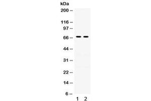 Western blot testing of human 1) A431 and 2) A549 lysate with Involucrin antibody. (Involucrin 抗体)