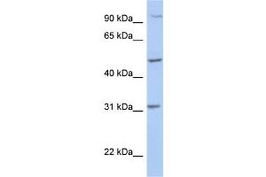 WB Suggested Anti-PPM1J Antibody Titration: 0. (PPM1J 抗体  (C-Term))