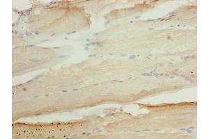 Immunohistochemistry (IHC) image for anti-ArfGAP with SH3 Domain, Ankyrin Repeat and PH Domain 3 (ASAP3) (AA 451-700) antibody (ABIN7144572)