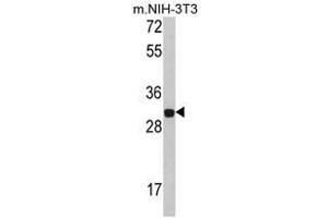 Image no. 1 for anti-Four and A Half LIM Domains 1 (FHL1) (C-Term) antibody (ABIN453000)