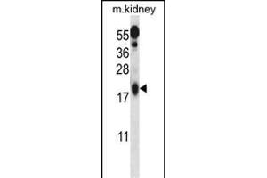 Ufc1 Antibody (C-term) (ABIN650703 and ABIN2839221) western blot analysis in mouse kidney tissue lysates (35 μg/lane). (UFC1 抗体  (C-Term))