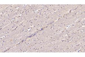 Detection of CHEM in Human Cerebrum Tissue using Monoclonal Antibody to Chemerin (CHEM) (CHEM (AA 33-158) 抗体)