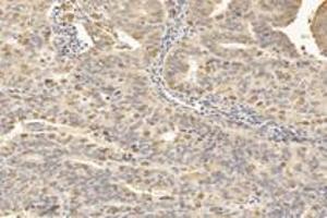 Immunohistochemistry (Paraffin-embedded Sections) (IHC (p)) image for anti-Tubulin Polymerization-Promoting Protein Family Member 3 (TPPP3) antibody (ABIN7076047)
