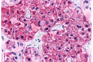 Immunohistochemistry (IHC) image for anti-Corticotropin Releasing Hormone Receptor 2 (CRHR2) (N-Term) antibody (ABIN1048468)