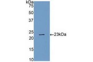 Detection of Recombinant CASP4, Human using Polyclonal Antibody to Caspase 4 (CASP4) (Caspase 4 抗体  (AA 78-265))
