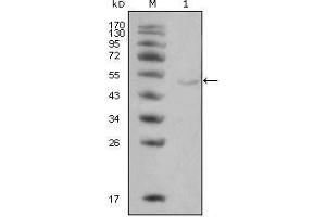 Western Blot showing LPL antibody used against Hela cell lysate (1). (Lipoprotein Lipase 抗体)
