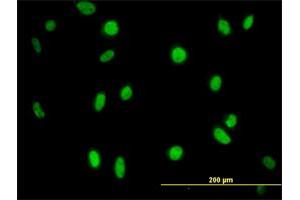 Immunofluorescence of monoclonal antibody to MPG on HeLa cell. (MPG 抗体  (AA 1-90))
