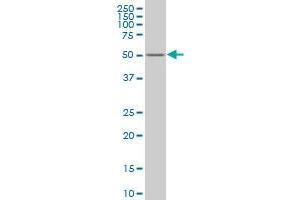 ZNF213 monoclonal antibody (M02), clone 3D3 Western Blot analysis of ZNF213 expression in K-562 . (ZNF213 抗体  (AA 133-242))