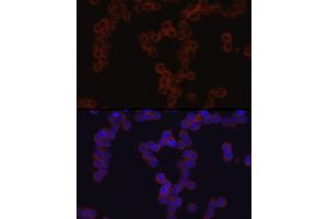 Immunofluorescence (IF) image for anti-Transforming Growth Factor, beta-Induced, 68kDa (TGFBI) (AA 481-683) antibody (ABIN3023373)