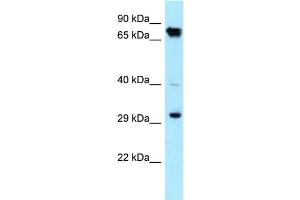 WB Suggested Anti-CDK4 Antibody Titration: 1. (CDK4 抗体  (C-Term))