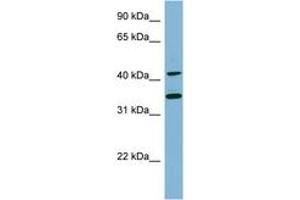 Image no. 1 for anti-B-Cell Linker (BLNK) (C-Term) antibody (ABIN6741821) (B-Cell Linker 抗体  (C-Term))