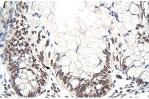 Rabbit Anti-ZNF394 Antibody Catalog Number: ARP30072 Paraffin Embedded Tissue: Human Intestine Cellular Data: Epithelial cells of intestinal villas Antibody Concentration: 4. (ZNF394 抗体  (N-Term))