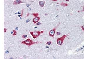 Image no. 3 for anti-Kinesin Family Member 5A (KIF5A) (Center) antibody (ABIN372915) (KIF5A 抗体  (Center))