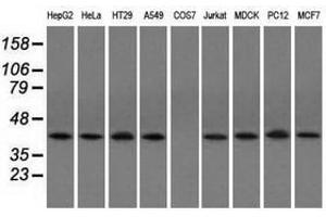 Image no. 2 for anti-Acetyl-CoA Acetyltransferase 2 (ACAT2) antibody (ABIN1496401) (ACAT2 抗体)