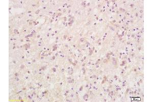 Formalin-fixed and paraffin embedded rat brain tissue labeled with Anti-Phospho-Caspase-9 (Thr125) Polyclonal Antibody, Unconjugated (ABIN683863) at 1:200 followed by conjugation to the secondary antibody and DAB staining (Caspase 9 抗体  (pThr125))