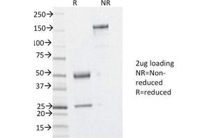 SDS-PAGE Analysis Purified YBX1 Mouse Monoclonal Antibody (YBX1/2430). (YBX1 抗体)