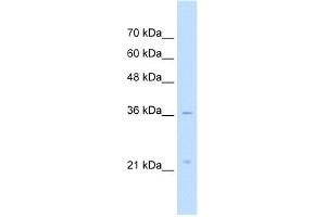 WB Suggested Anti-LAPTM4A Antibody Titration:  5. (LAPTM4A 抗体  (Middle Region))