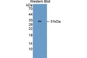 Western blot analysis of the recombinant protein. (GLDC 抗体  (AA 521-761))