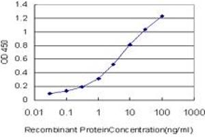 Detection limit for recombinant GST tagged TLR5 is approximately 0. (TLR5 抗体  (AA 517-634))
