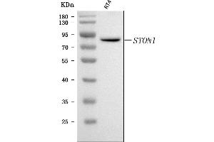 Western blot analysis of STON1 using anti-STON1 antibody (ABIN7599896).