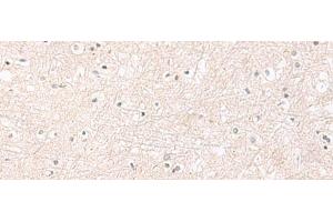 Immunohistochemistry of paraffin-embedded Human brain tissue using FGFR4 Polyclonal Antibody at dilution of 1:25(x200) (FGFR4 抗体)