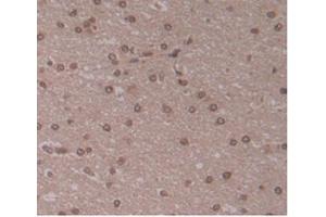 IHC-P analysis of Human Brain Tissue, with DAB staining. (ENPP2 抗体  (AA 637-905))