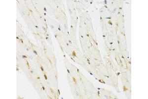 Immunohistochemistry of paraffin-embedded Mouse heart using THAP1 Polyclonal Antibody at dilution of 1:100 (40x lens). (THAP1 抗体)