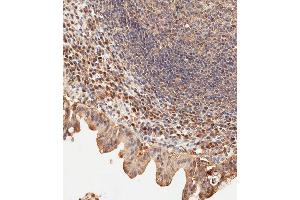 Immunohistochemical analysis of paraffin-embedded human epityphlon tissue using (ABIN388904 and ABIN2839189) performed on the Leica® BOND RXm. (USP15 抗体  (N-Term))