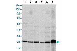 Western blot analysis using CASP8 monoclonal antibody, clone 1H11  against HeLa (1), Jurkat (2), THP-1 (3), NIH/3T3 (4), COS-7 (5) and PC-12 (6) cell lysate. (Caspase 8 抗体)