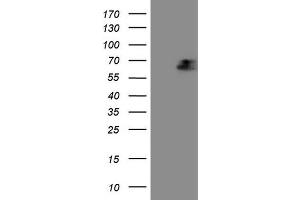 Western Blotting (WB) image for anti-alpha-Fetoprotein (AFP) (AA 19-397) antibody (ABIN2716009)