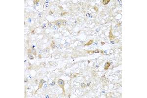 Immunohistochemistry of paraffin-embedded rat brain using CBR4 antibody at dilution of 1:100 (x40 lens). (CBR4 抗体)