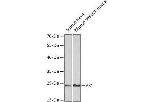 Western blot analysis of extracts of various cell lines using AK1 Polyclonal Antibody at dilution of 1:1000. (Adenylate Kinase 1 抗体)