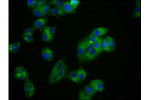 Immunofluorescence staining of HepG2 cells with ABIN7174072 at 1:100, counter-stained with DAPI. (ROR2 抗体  (AA 752-926))