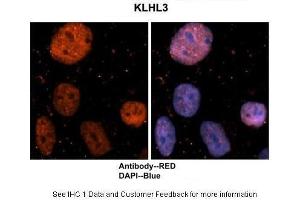 Sample Type : Human brain stem cells Primary Antibody Dilution : 1:500 Secondary Antibody : Goat anti-rabbit Alexa-Fluor 594 Secondary Antibody Dilution : 1:1000 Color/Signal Descriptions : KLHL3: Red DAPI:Blue Gene Name : KLHL3 Submitted by : Dr. (KLHL3 抗体  (N-Term))