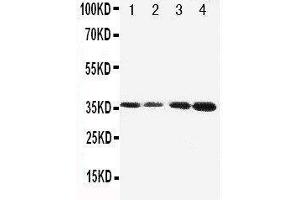 Anti-Protein C antibody, Western blotting Lane 1: JURKAT Cell Lysate Lane 2: CEM Cell Lysate Lane 3: SMMC Cell Lysate Lane 4: HELA Cell Lysate (PROC 抗体  (C-Term))