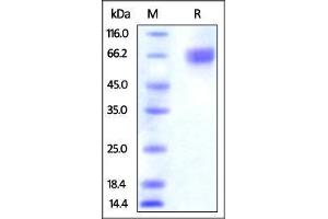 SDS-PAGE (SDS) image for Nectin cell adhesion molecule 3 (NECTIN3) (AA 58-400) protein (His tag) (ABIN4949137)