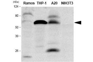 Western Blotting (WB) image for anti-Interferon Regulatory Factor 5 (IRF5) antibody (ABIN361079) (IRF5 抗体)