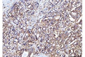 IHC analysis of Poliovirus Receptor/PVR using anti-Poliovirus Receptor/PVR antibody (ABIN7601071).